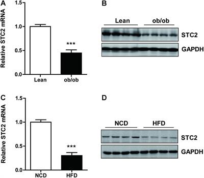 Stanniocalcin 2 Ameliorates Hepatosteatosis Through Activation of STAT3 Signaling